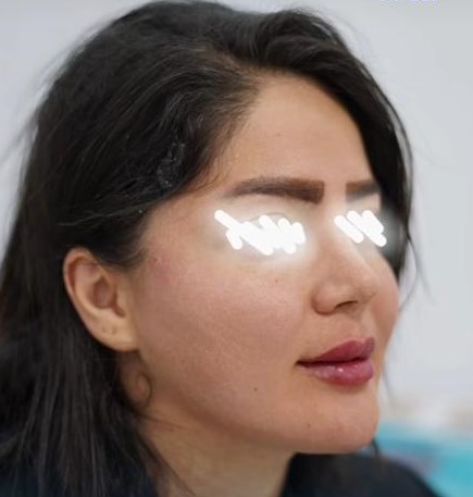 کانتورینگ صورت