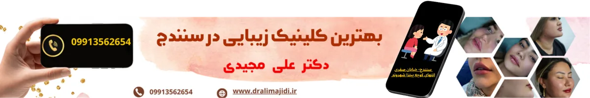 بهترین دکتر تزریق بوتاکس در سنندج