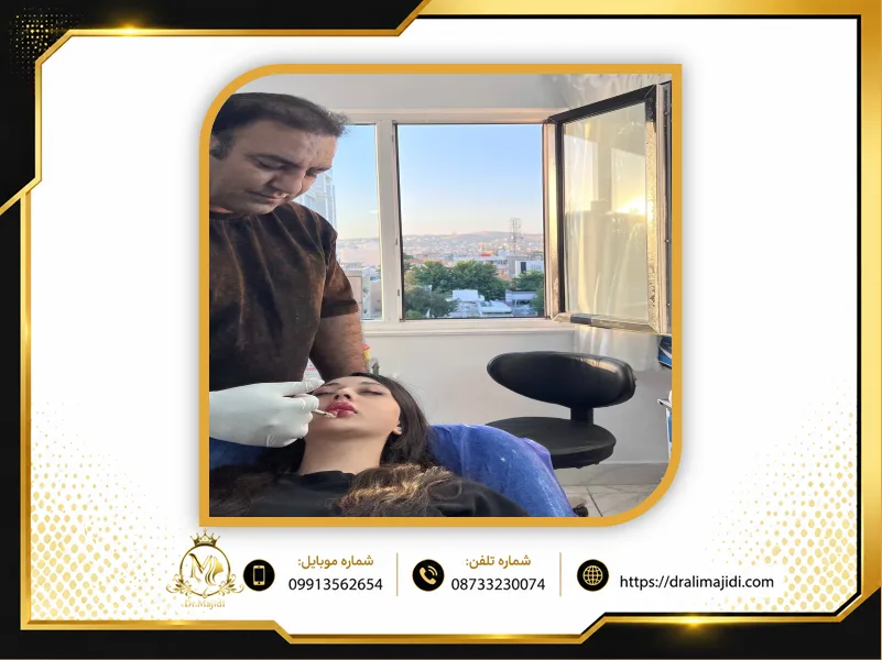 بهترین دکتر تزریق فیلر لب در سنندج