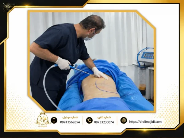 بهترین دکتر ساکشن شکم و پهلو در سنندج