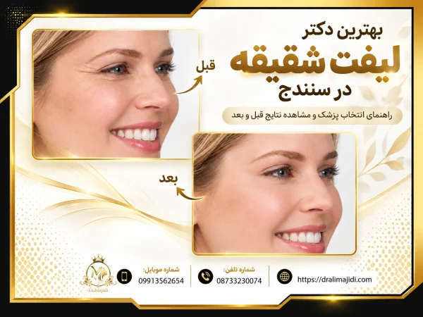 بهترین دکتر لیفت شقیقه در سنندج